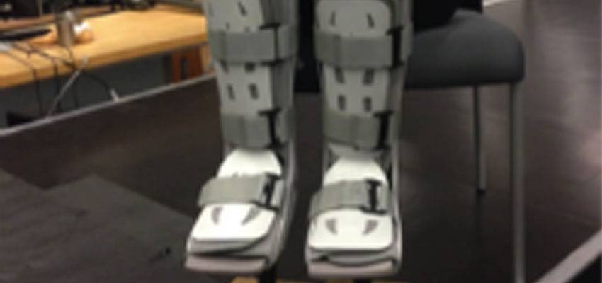 D-Lab: Prosthetics for the Developing World – Back for Fall 2015! | MIT ...